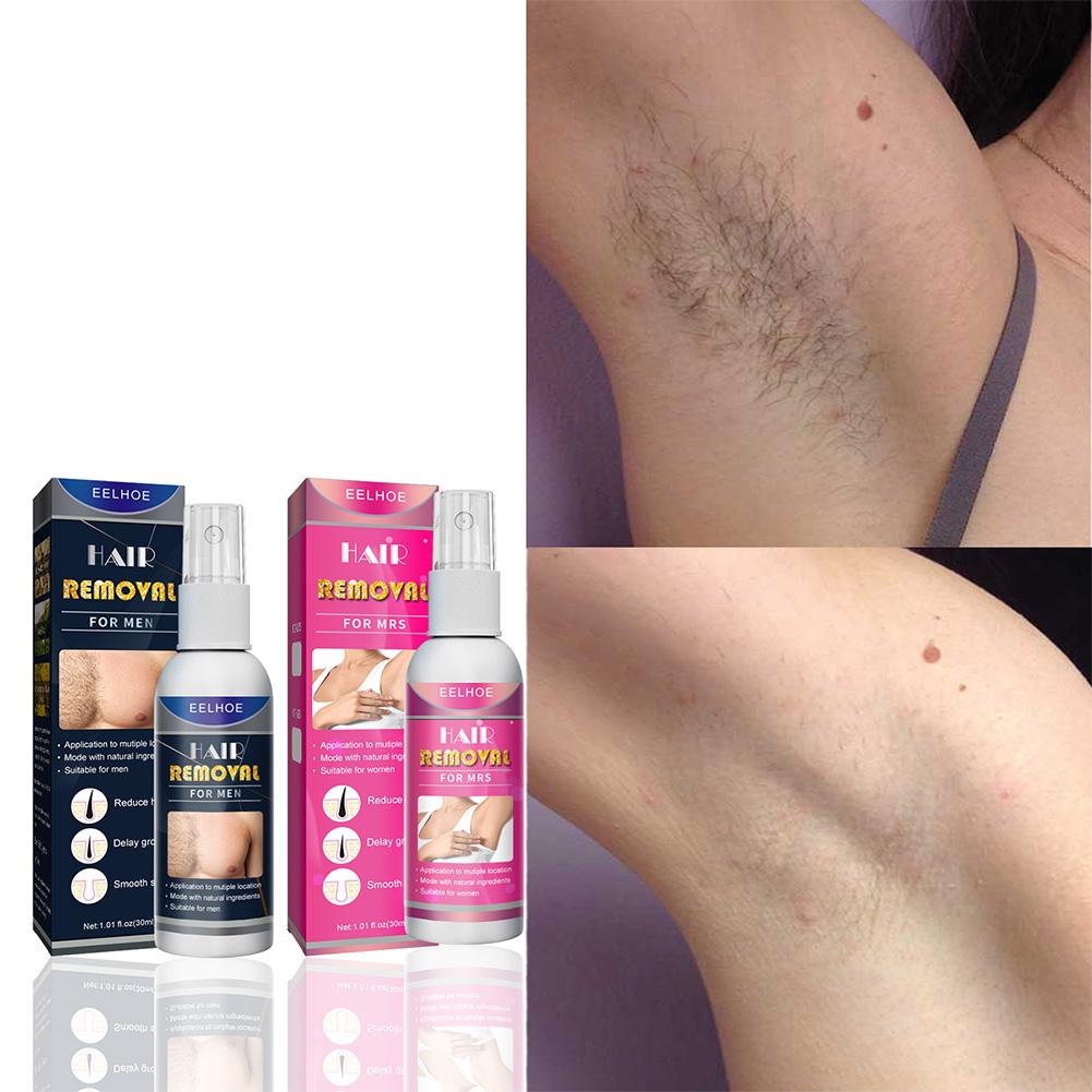 1/2PCS Super Natural Painless  - Hair Care Women 评论和价格